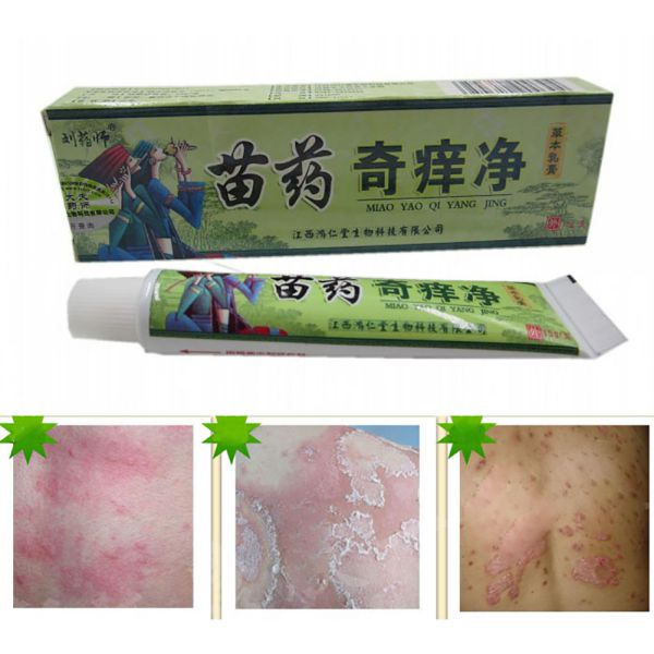 15g Anti-itch Cream Ointment Chinese Traditional Herbal Cream FOR ...
